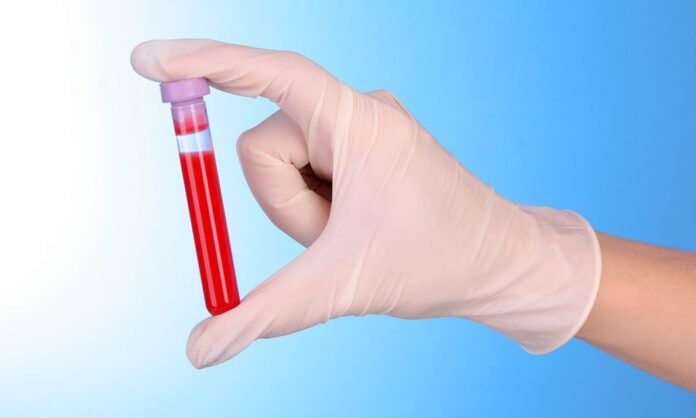 Bigstock Test Tube With Blood In Hand O 16096928