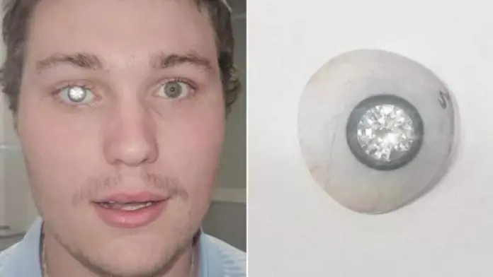 Diamond eye