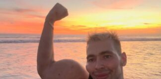 Κινδυνεύει να χάσει τα χέρια του ο «Ρώσος Ποπάι»: Έπαθε σοβαρή μόλυνση από τις ενέσεις για να μεγαλώσουν τα μπράτσα Popeye