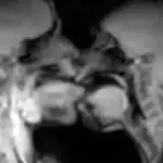 Έκαναν σεξ μέσα σε μαγνητικό τομογράφο και κατέληξαν σε επιστημονική ανακάλυψη Sex mri