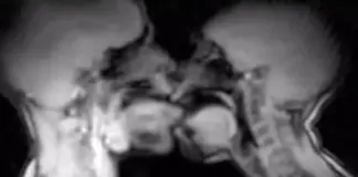 Έκαναν σεξ μέσα σε μαγνητικό τομογράφο και κατέληξαν σε επιστημονική ανακάλυψη Sex mri