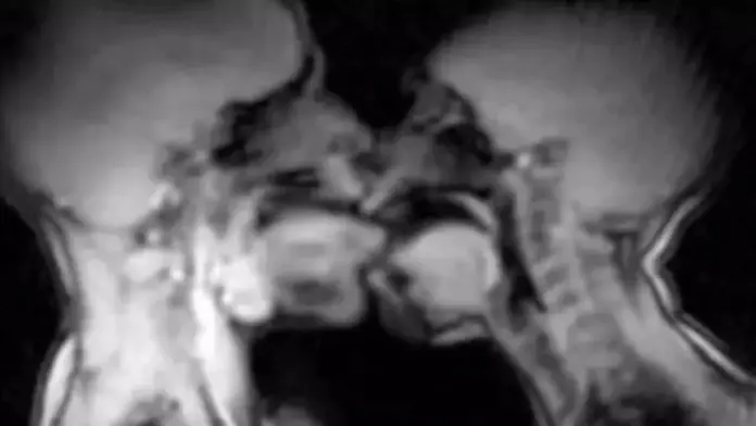 Sex mri