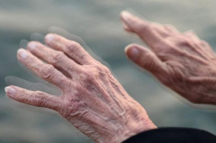 παρκινσον 1 1024x680